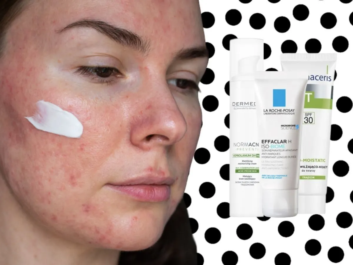 Kremy do cery trądzikowej ranking