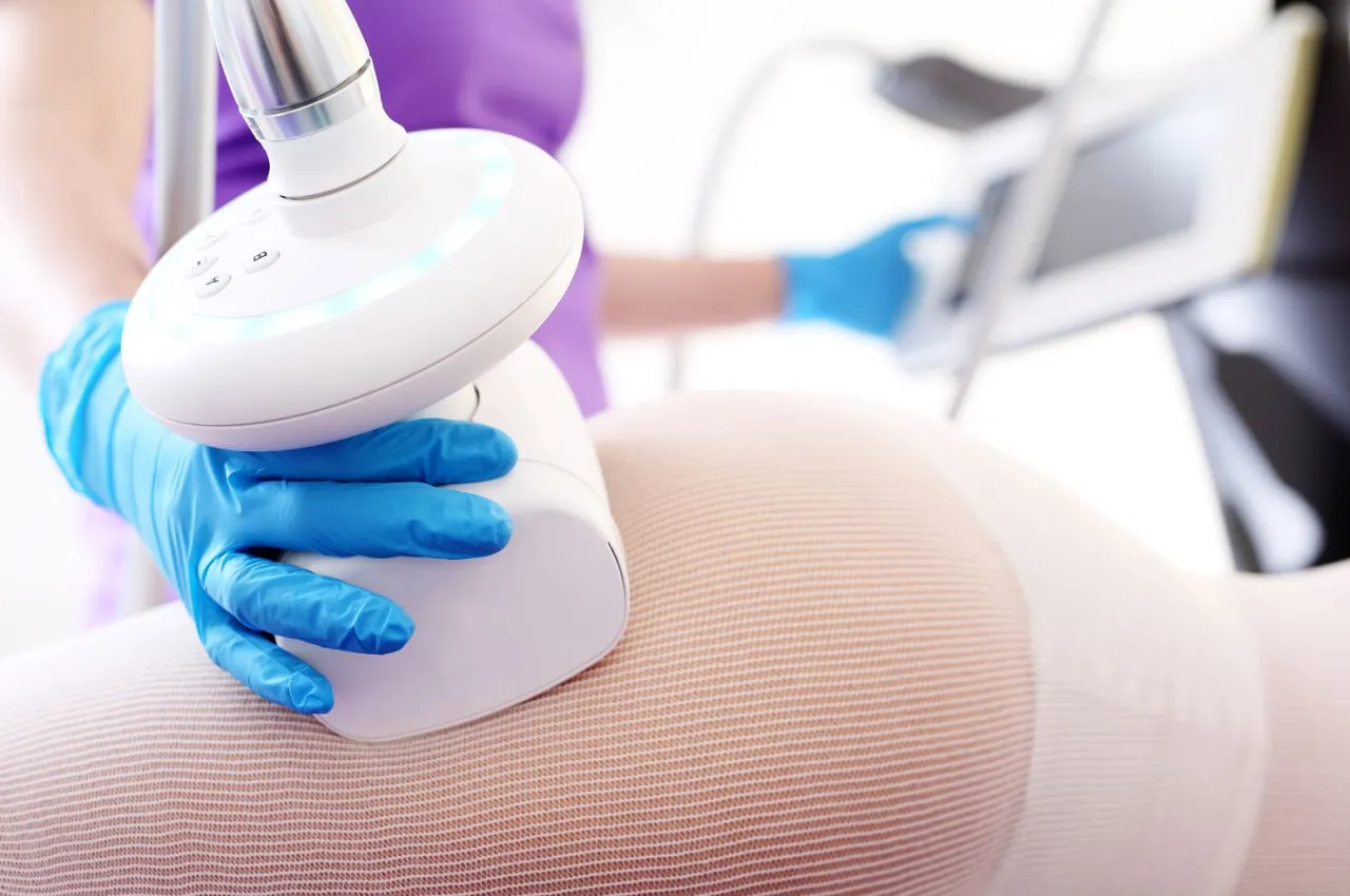 Endermologia zabieg urządzenie