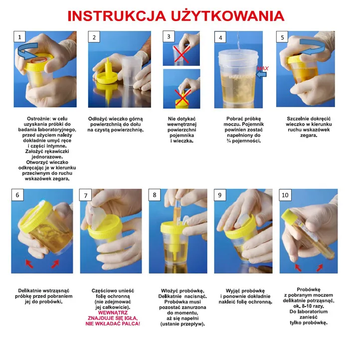 Pojemnik na mocz i pr&oacute;bka moczu