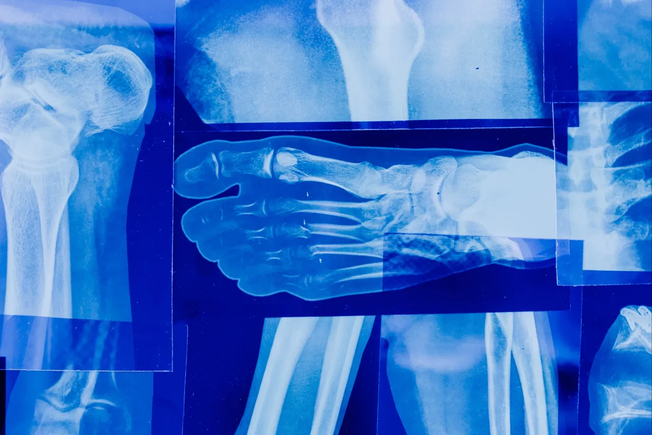 ortopeda leczy wady postawy złamania