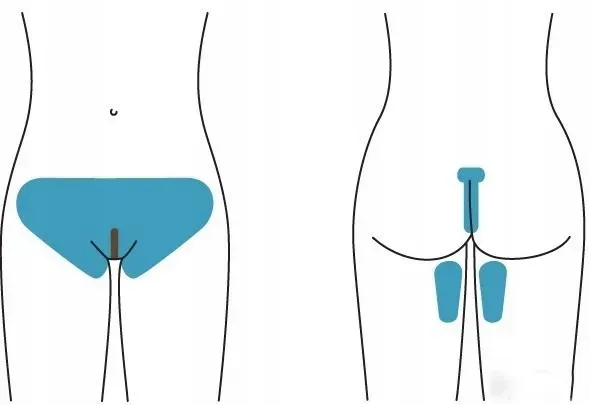 golenie miejsc intymnych bez podrażnień instrukcja