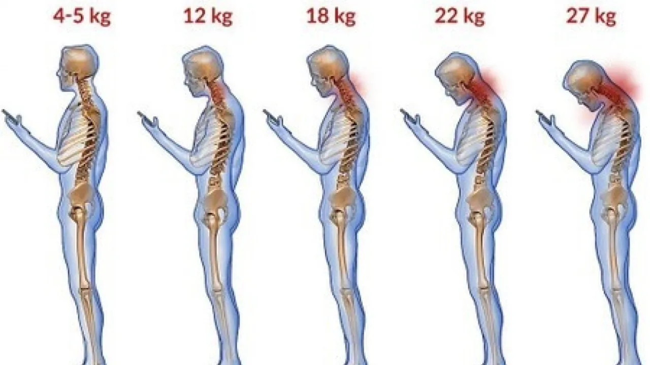 stopnie skręcenia kręgosłupa szyjnego infografika