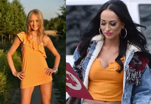 Siostry Godlewskie operacje plastyczne przed po