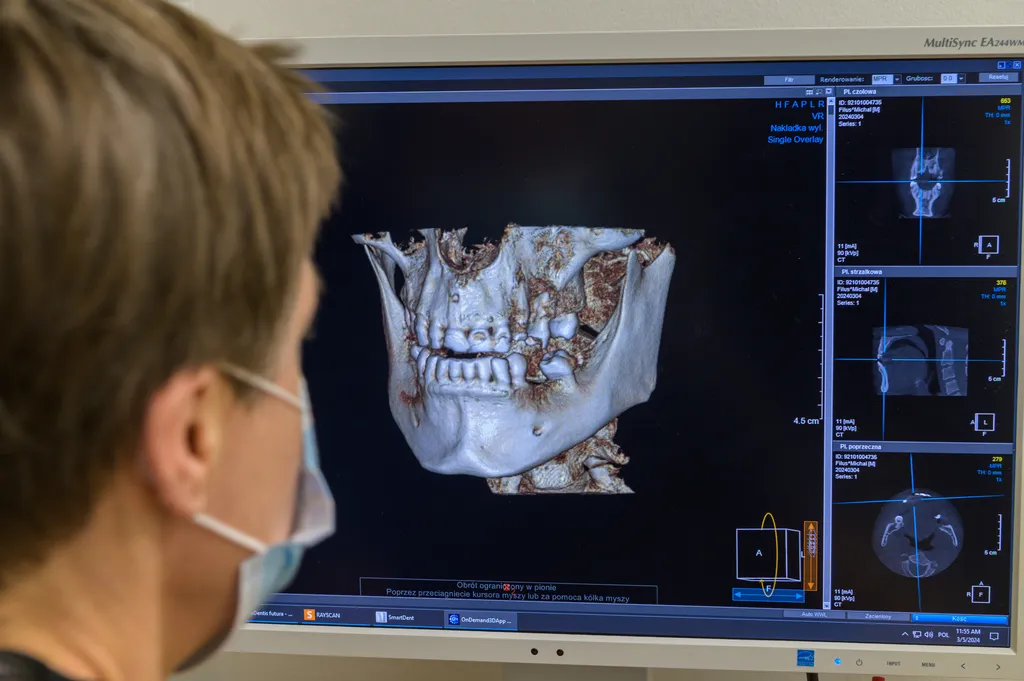 rentgen zęba diagnostyka stomatologiczna