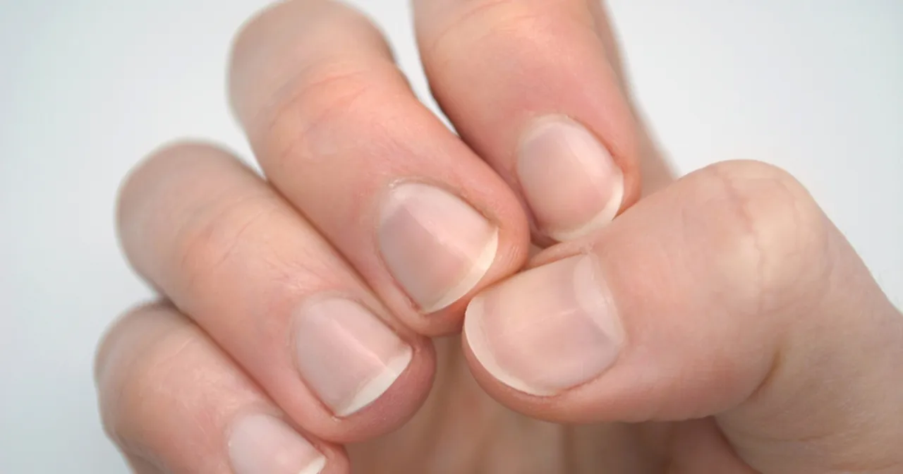 zdrowe paznokcie, prawidłowa pielęgnacja paznokci