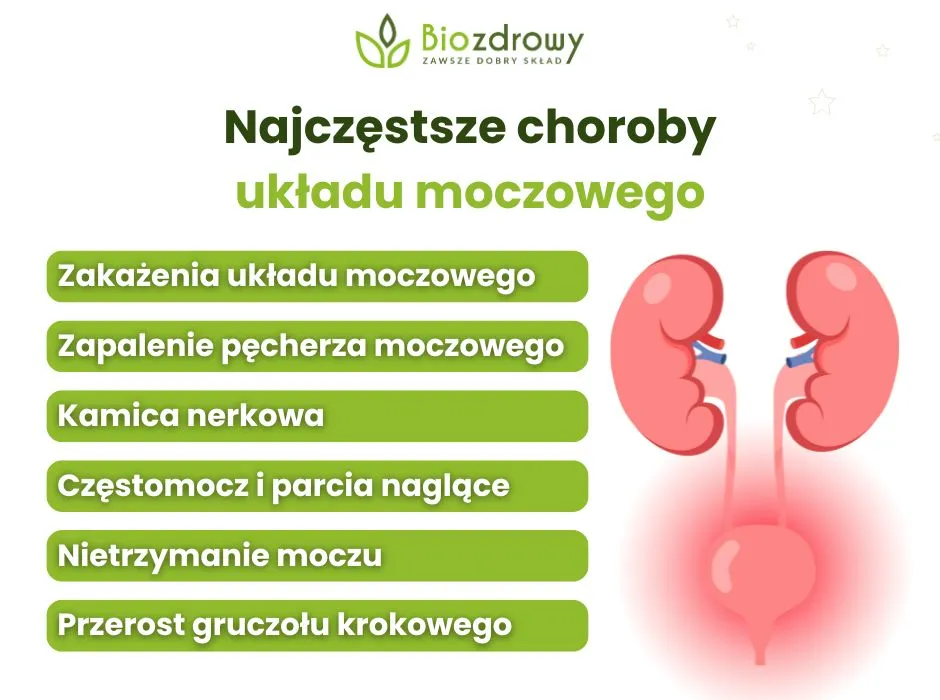 Objawy chorób układu moczowego infografika