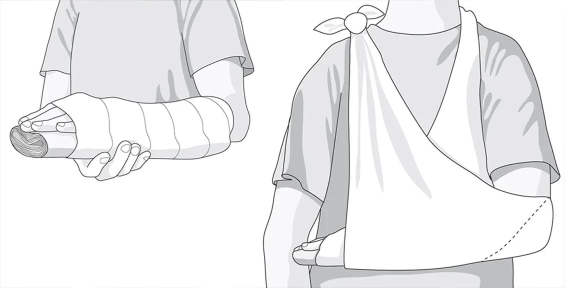 pierwsza pomoc przy urazach stawów