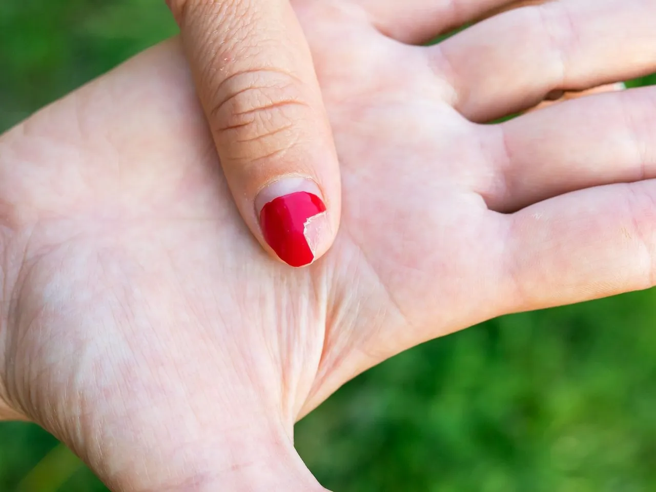 Jak prawidłowo opatrzyć palec po utracie paznokcia