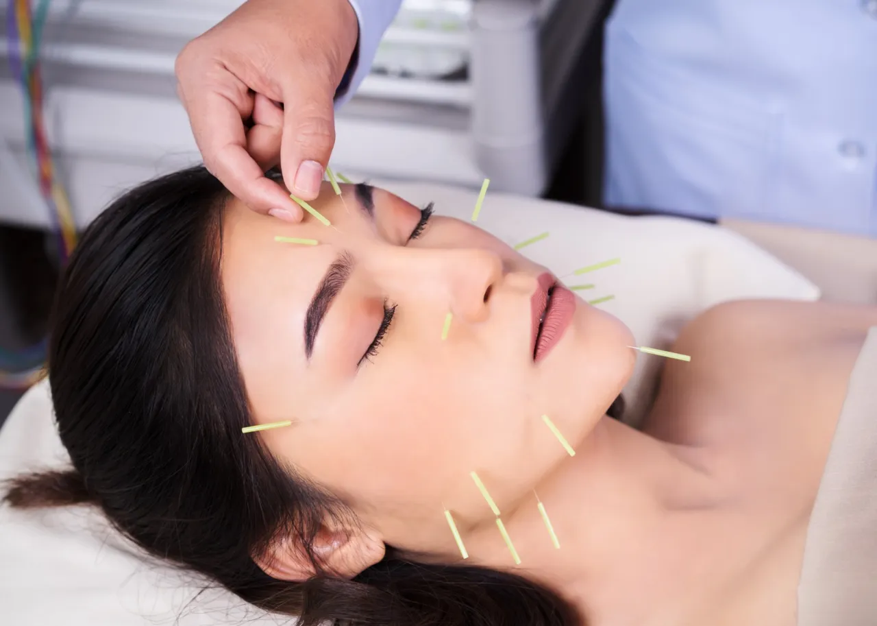 Akupunktura Kraków cennik tabela