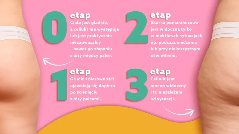 Domowe sposoby na cellulit przed i po, szczotkowanie na sucho, peeling kawowy