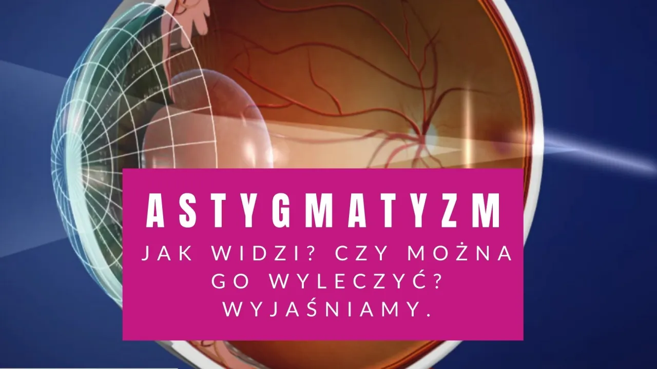 astygmatyzm rog&oacute;wka piłka rugby por&oacute;wnanie