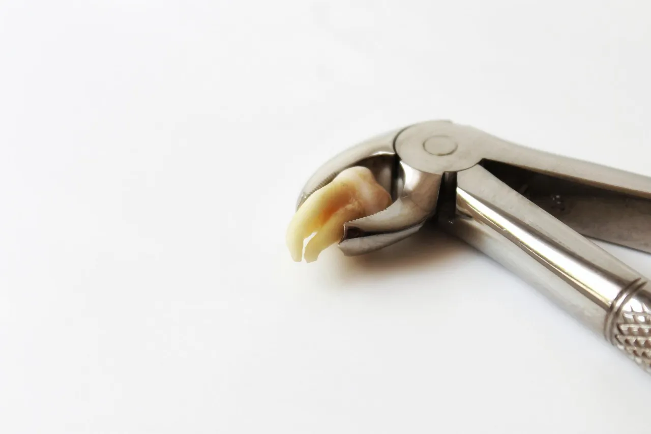 Ekstrakcja zęba narzędzia