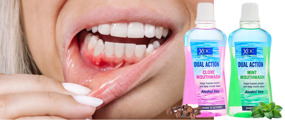 domowe sposoby na krwawiące dziąsła