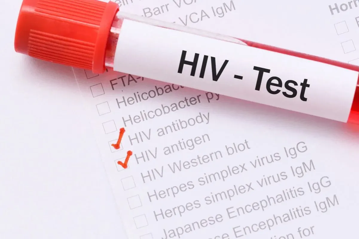 Rodzaje testów na HIV schemat