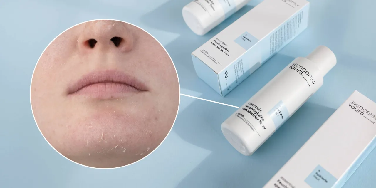 Hautpflege Routine schuppige Haut