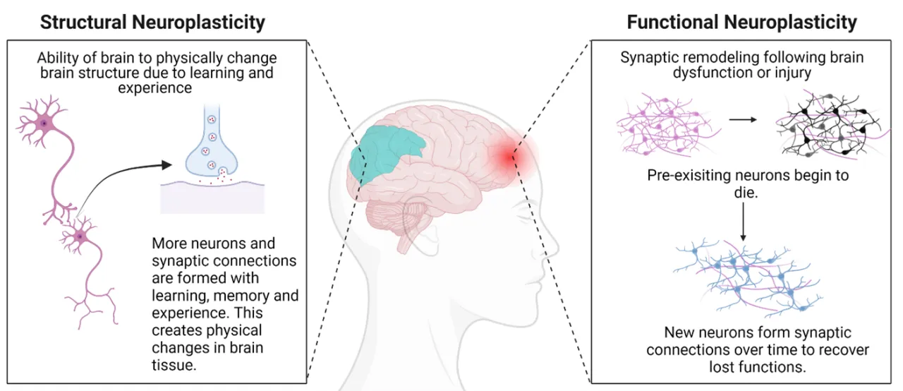 neuroplasticity brain connections