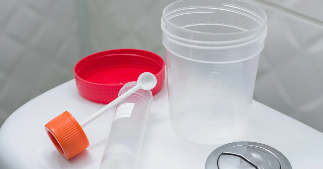 produkty zakazane przed badaniem kału na krew utajoną