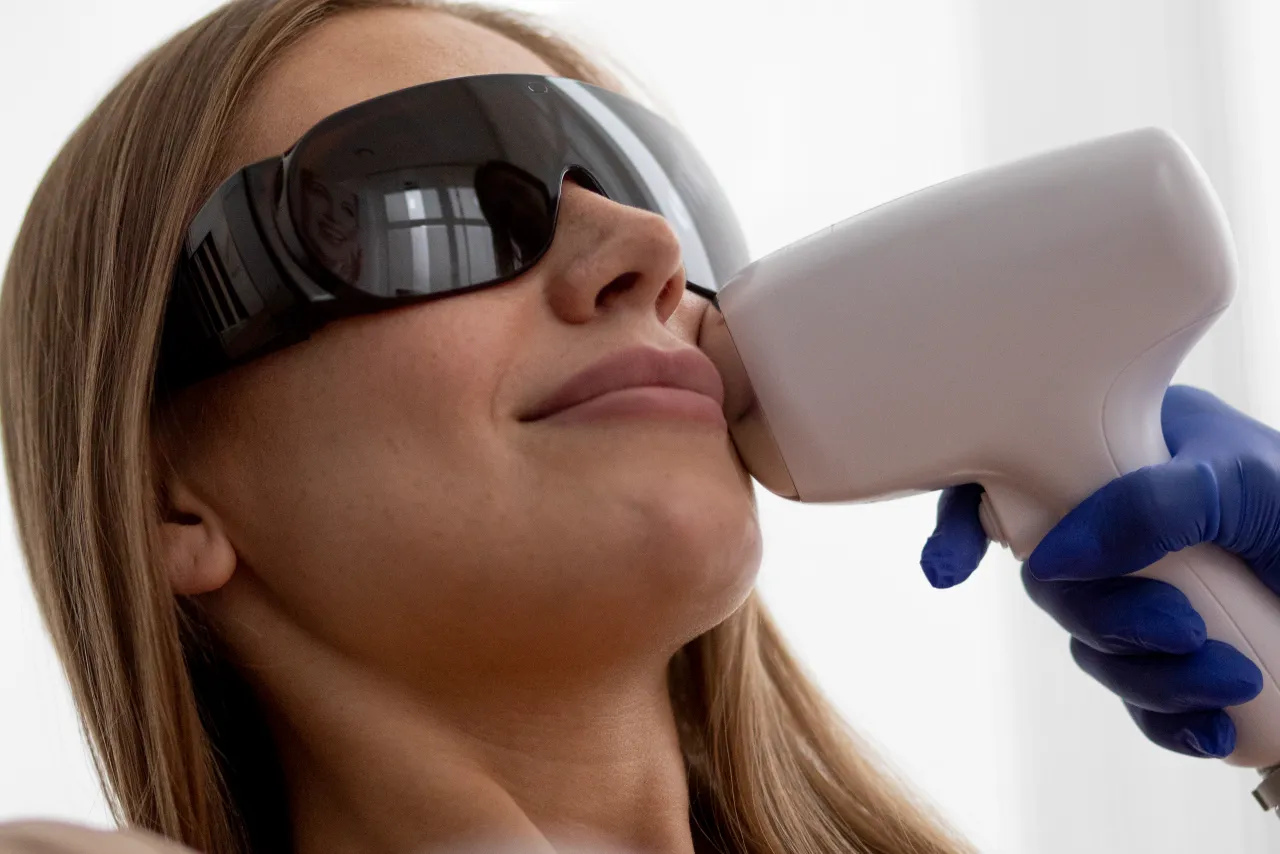 depilacja laserowa wąsika