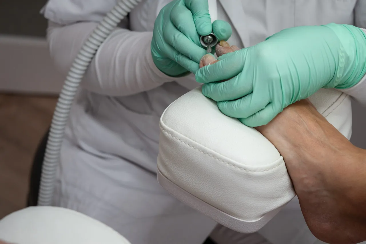 trepanacja paznokcia zabieg