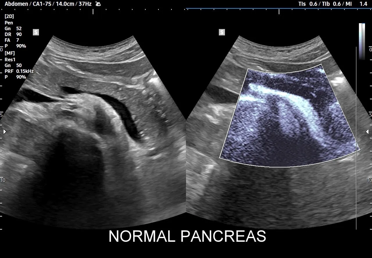 Objawy chorej trzustki infografika