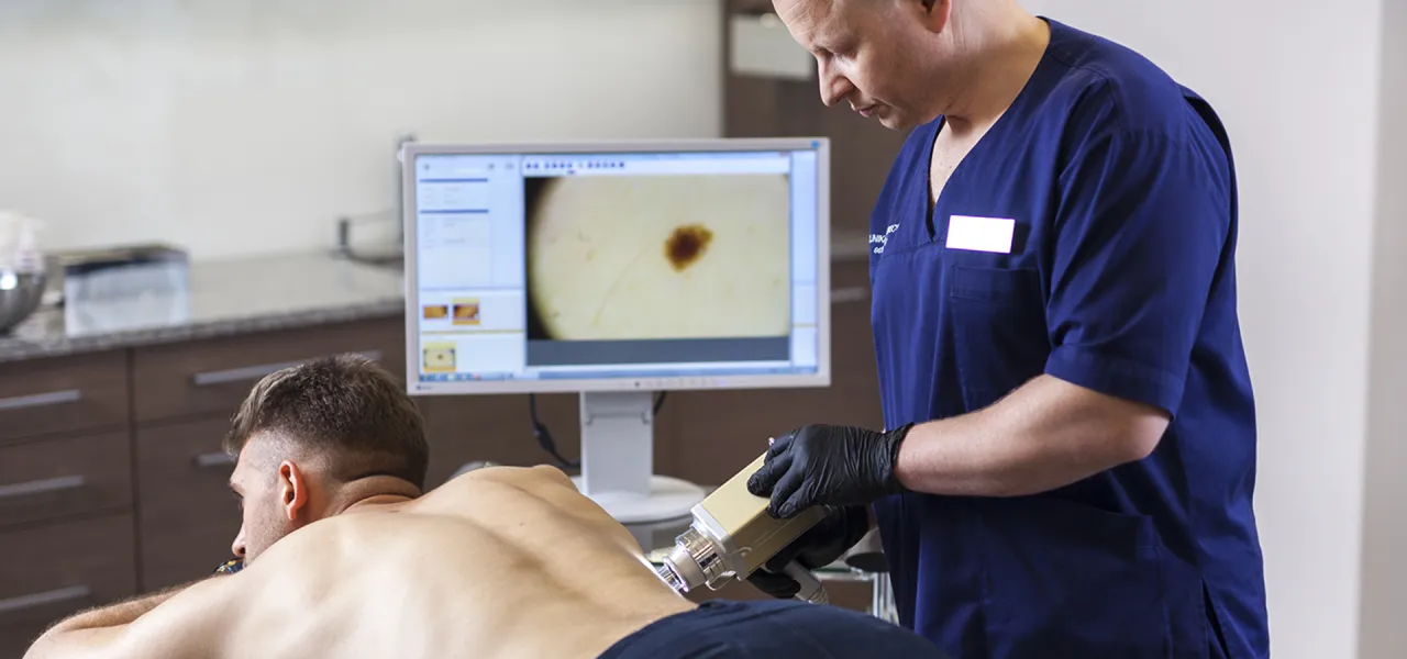 Dermatolog badający znamiona dermatoskopem