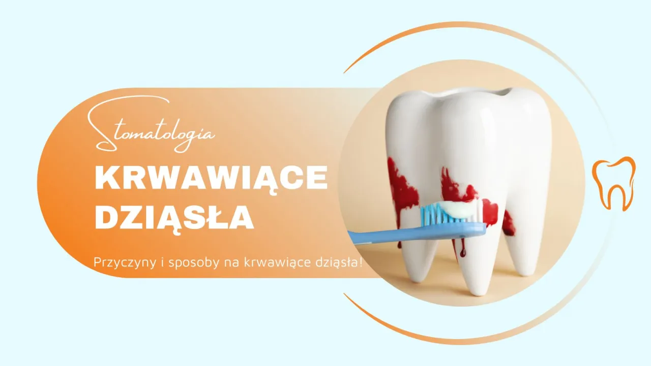 przyczyny krwawiących dziąseł infografika