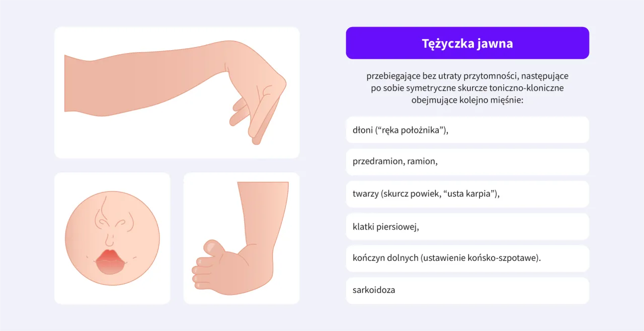 Zdjęcie Tężyczka jaki lekarz - kluczowe informacje o specjalistach i diagnozie