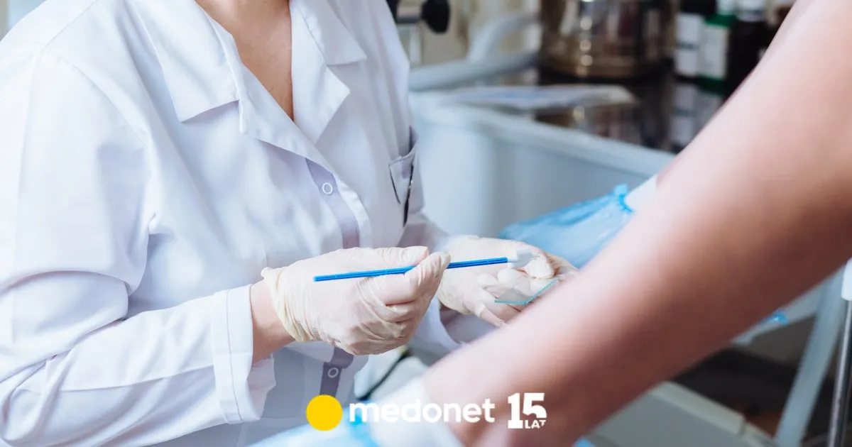 Zdjęcie Czy cytologia płynna jest na NFZ? Sprawdź, czy masz dostęp bezpłatnie
