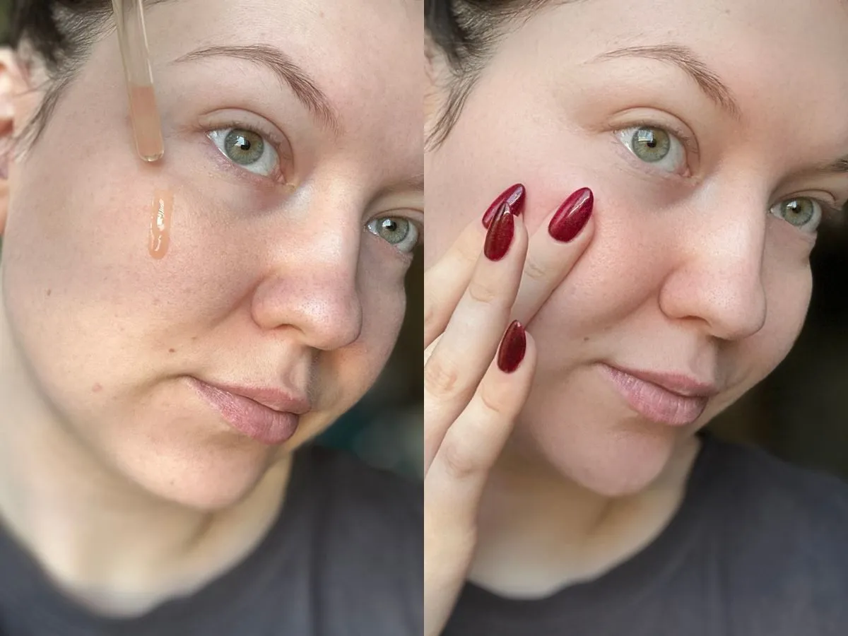 efekty stosowania Effaclar Duo+ SPF30 przed i po