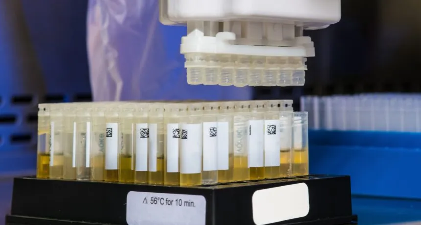 Rodzaje pr&oacute;bek do test&oacute;w na narkotyki: mocz, krew, włosy