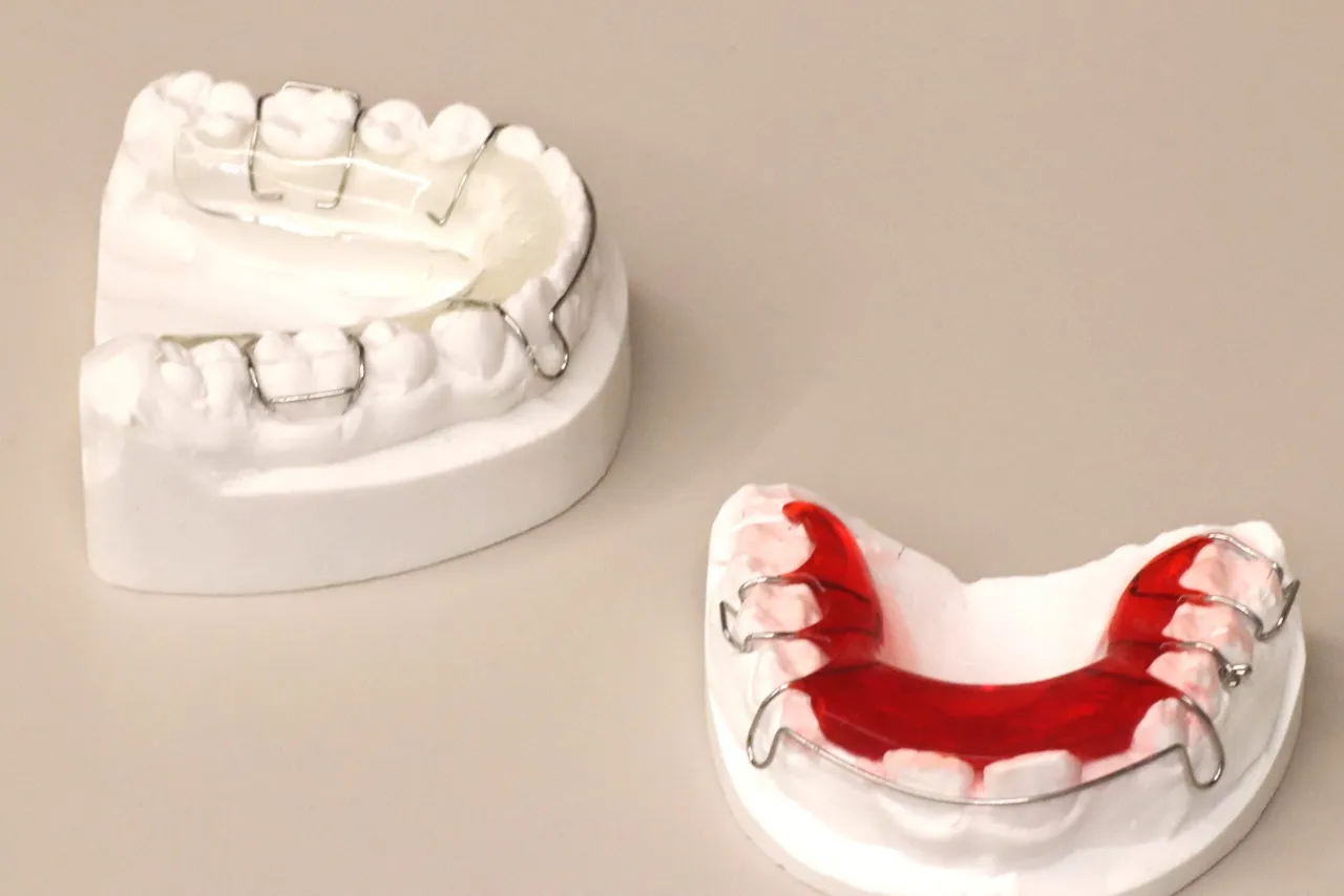 aparaty retencyjne stałe i ruchome