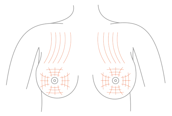 zabiegi medycyny estetycznej na biust fale radiowe hifu nici liftingujące