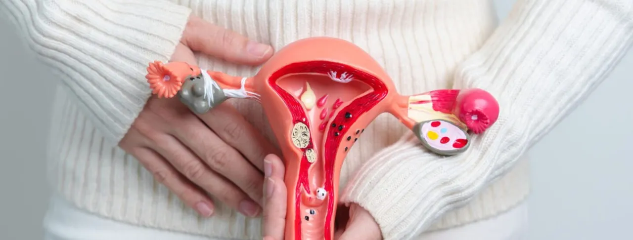 Zdjęcie Jakie leki hormonalne na torbiel jajnika mogą naprawdę pomóc?