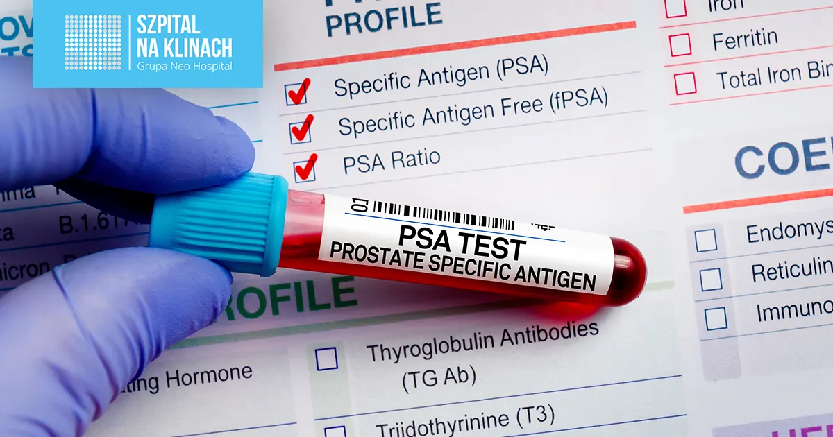 Zdjęcie Jakie badania na prostatę z krwi? Kluczowe informacje, które musisz znać