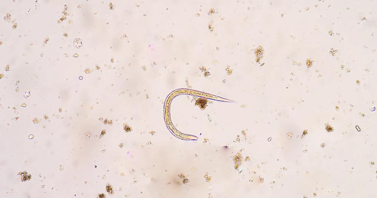 r&oacute;żne pasożyty ludzkie przykłady