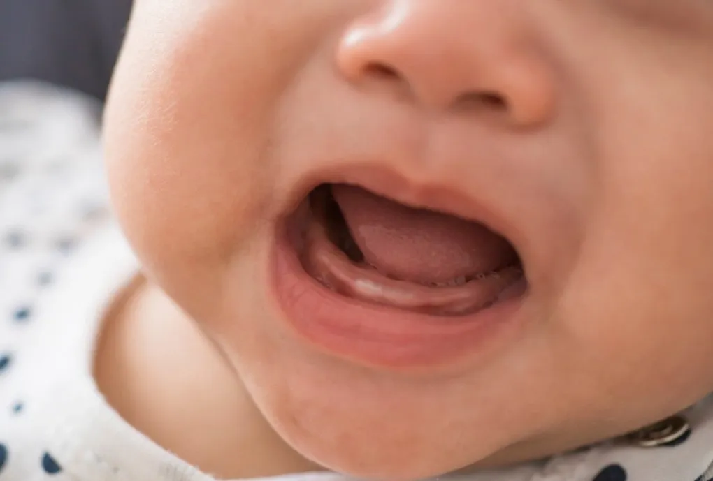 dziąsła niemowlaka ząbkowanie wygląd