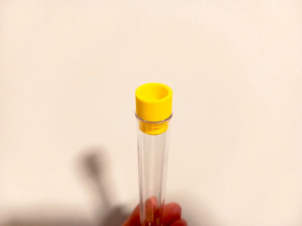 Og&oacute;lne badanie moczu prob&oacute;wka