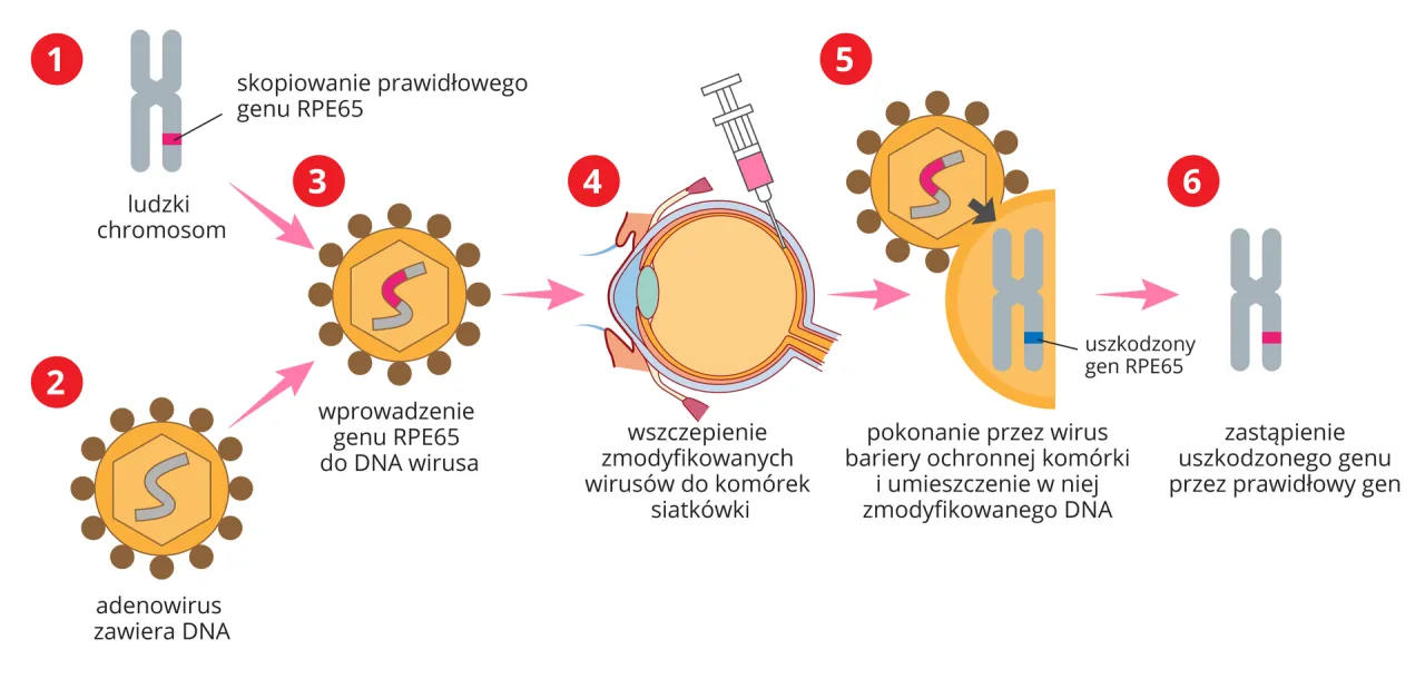Wektor wirusowy terapia genowa schemat