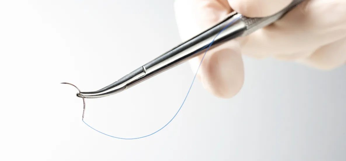 rodzaje szwów stomatologicznych rozpuszczalne nierozpuszczalne