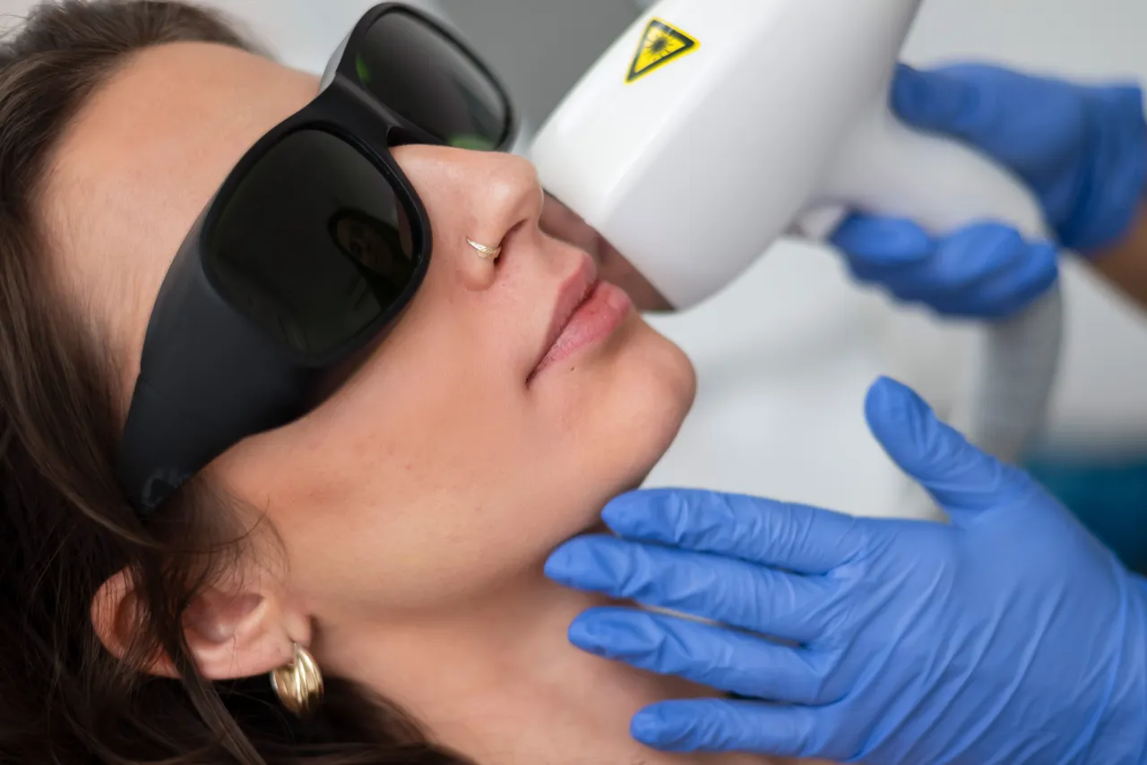 profesjonalne zabiegi depilacji twarzy laser elektroliza nitkowanie