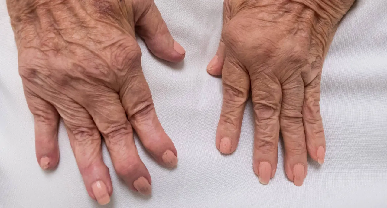 Diagnostyka medyczna, badania krwi, lekarz i pacjent, reumatolog