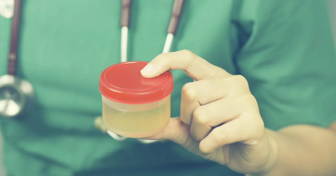 Mocz prawidłowy a zmieniony zapach