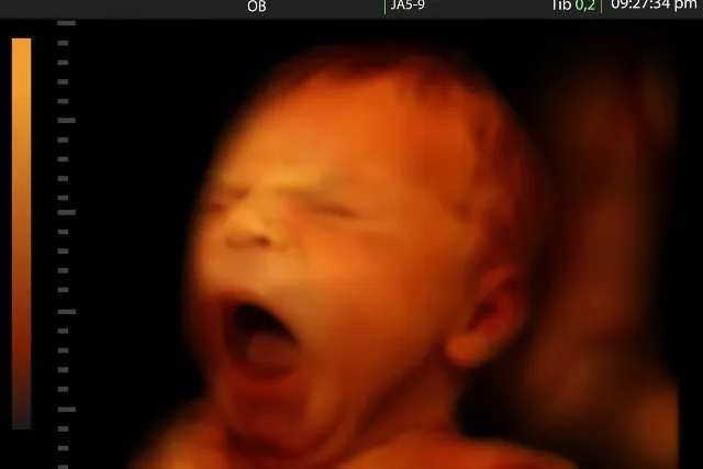 pł&oacute;d 6 miesiąc ciąży wygląd