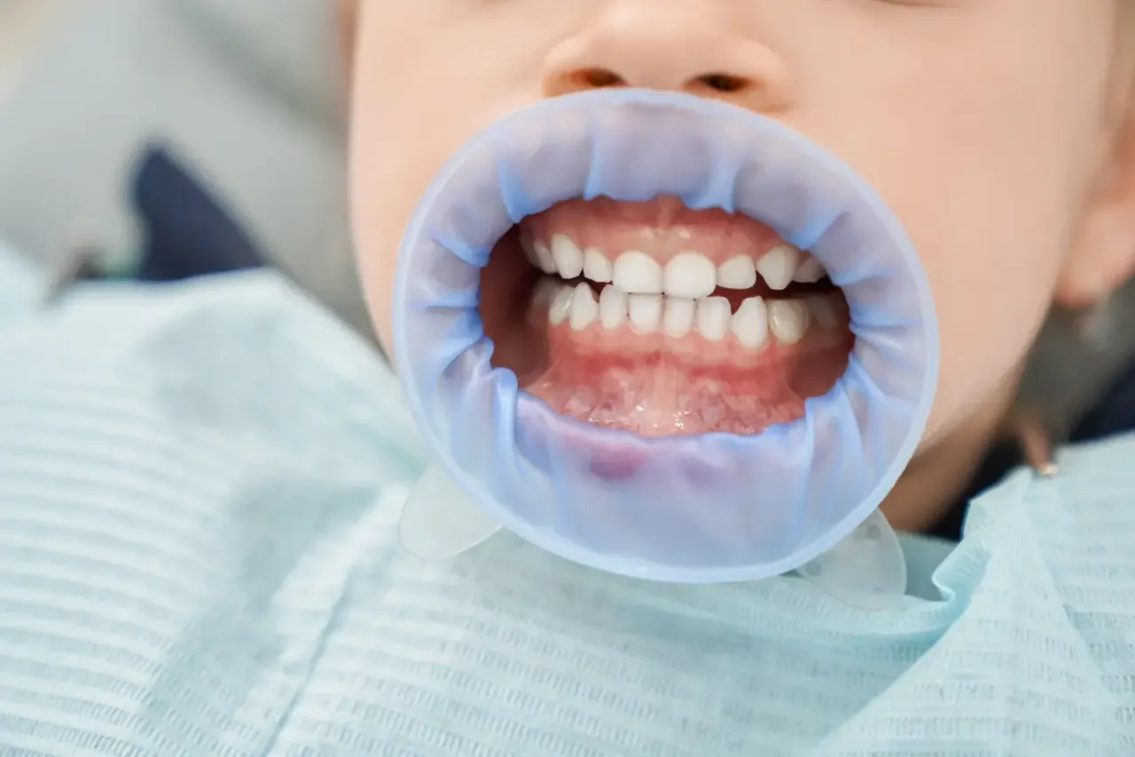 funkcje zębów mlecznych u dziecka
