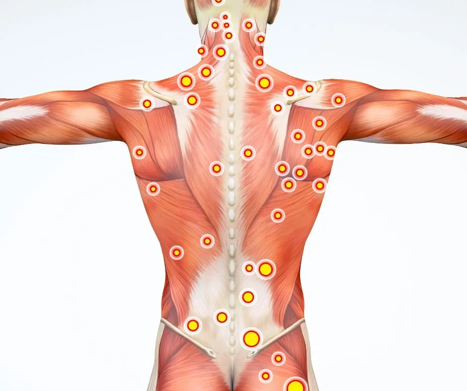 Mapa mięśni plec&oacute;w do masażu