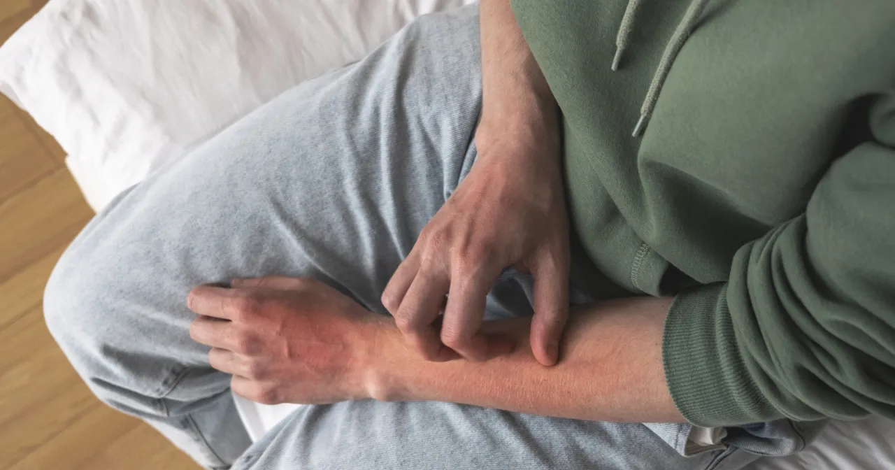 Przerzuty raka jelita grubego na skórze