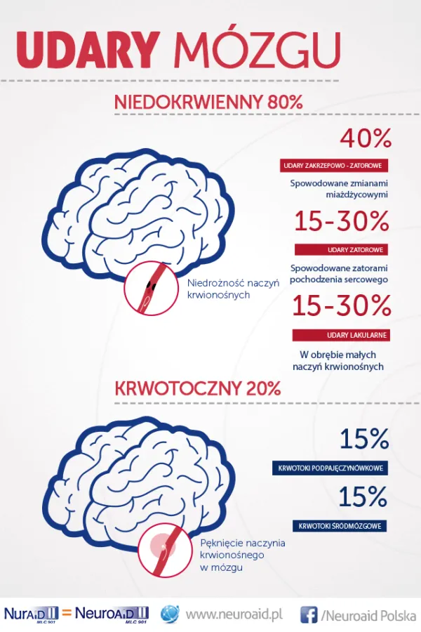 Zdjęcie Ile żyje człowiek po udarze? Statystyki i czynniki przeżywalności