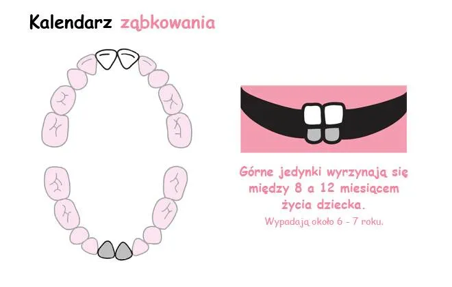 Zdjęcie Jak wyglądają dziąsła przy ząbkowaniu górnych jedynek? Objawy i porady dla rodziców