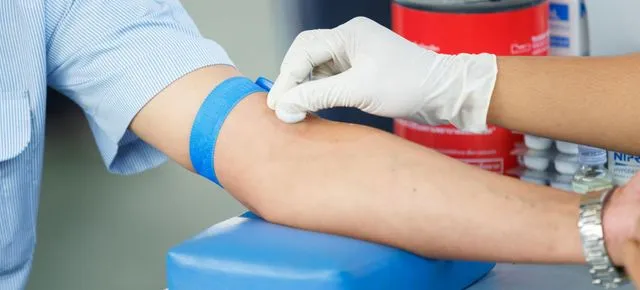 Zdjęcie Podwyższony poziom CA 125: Dlaczego warto znać jego znaczenie w diagnostyce