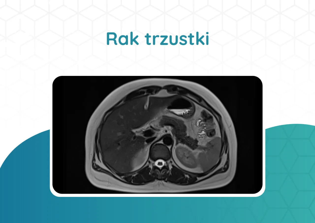 Badania diagnostyczne trzustki USG TK MRI